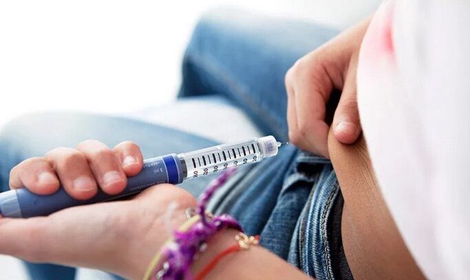 Schwéier Diabetis erfuerdert konstant Insulininjektiounen